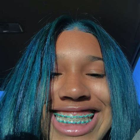 teal braces on dark skin.